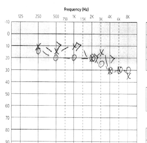Hearing Graph Oct 2020