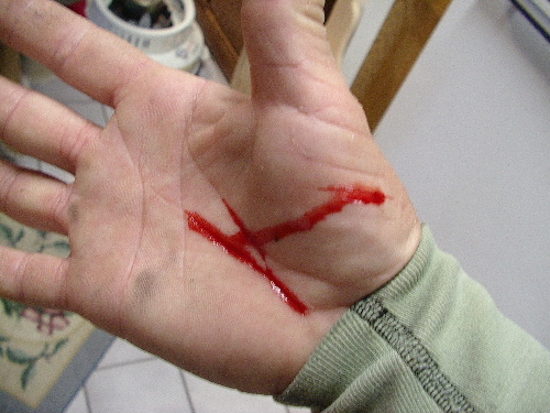 A Love bite