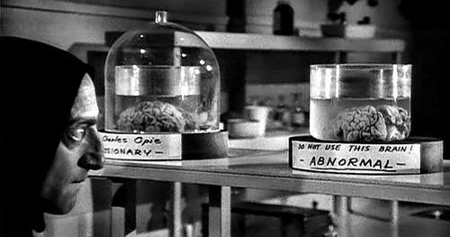 A B Normal brain